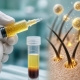 Fostoria News Hair restoration science: syringe and vial with focus on hair follicles.